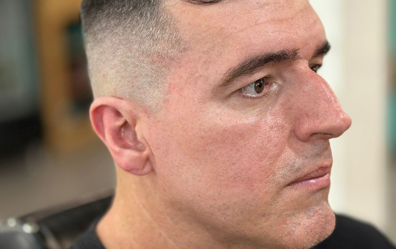 Conheca os cuidados pos barba para evitar irritacoes